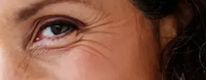 bloc ageing of the skin