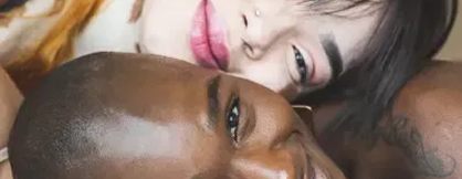 banner-entendasuapele